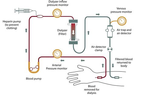 normal blood draw in hemodialysis